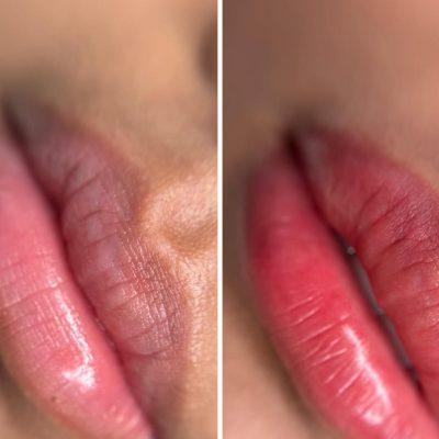 aquarelle lips before after healing