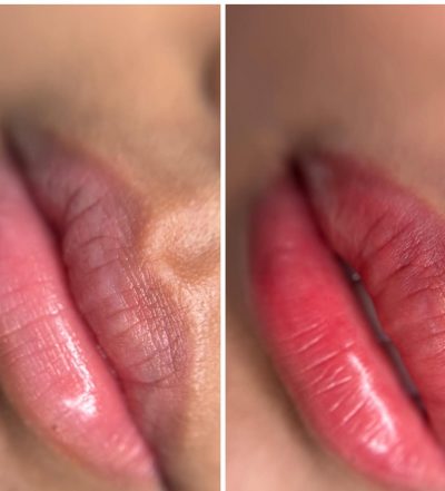 aquarelle lips before after healing