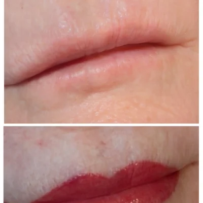 aquarelle lips before after healing