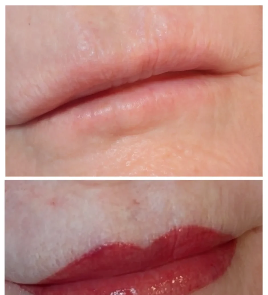 aquarelle lips before after healing