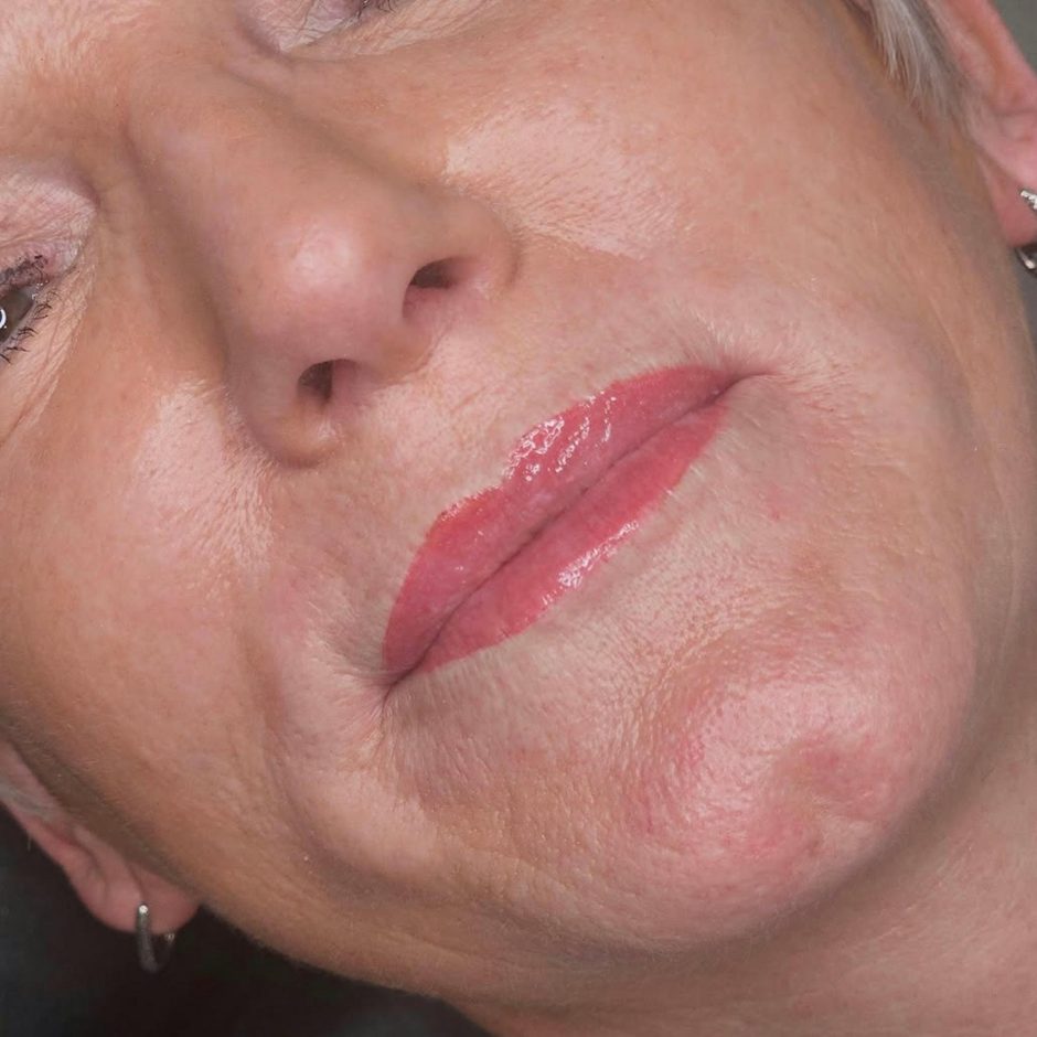 aquarelle lips before after healing
