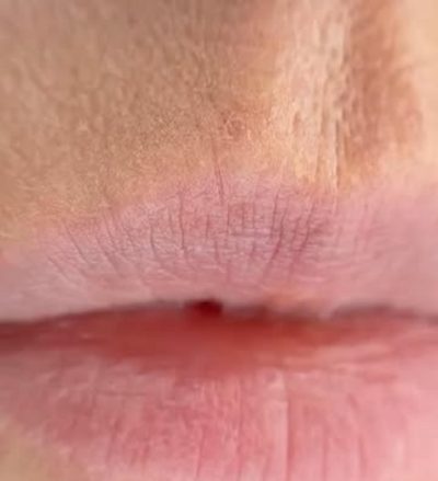 aquarelle lips before after older skin