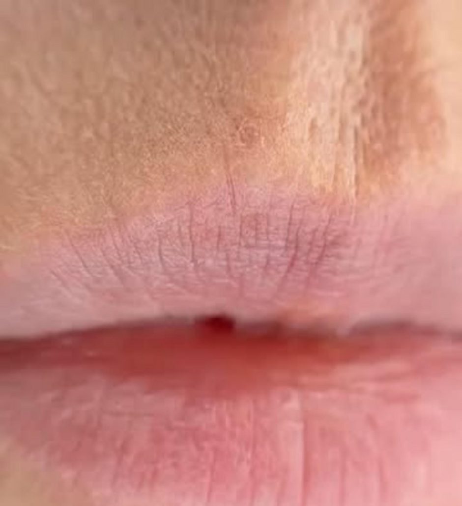 aquarelle lips before after older skin
