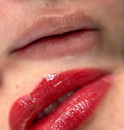 aquarelle lips before and after healing