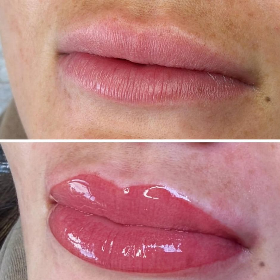 aquarelle lips before and after photo