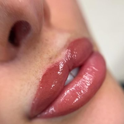 aquarelle lips before and after results