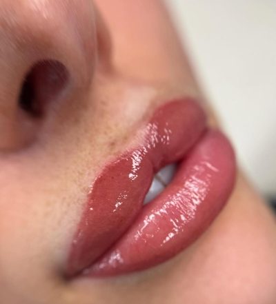 aquarelle lips before and after results