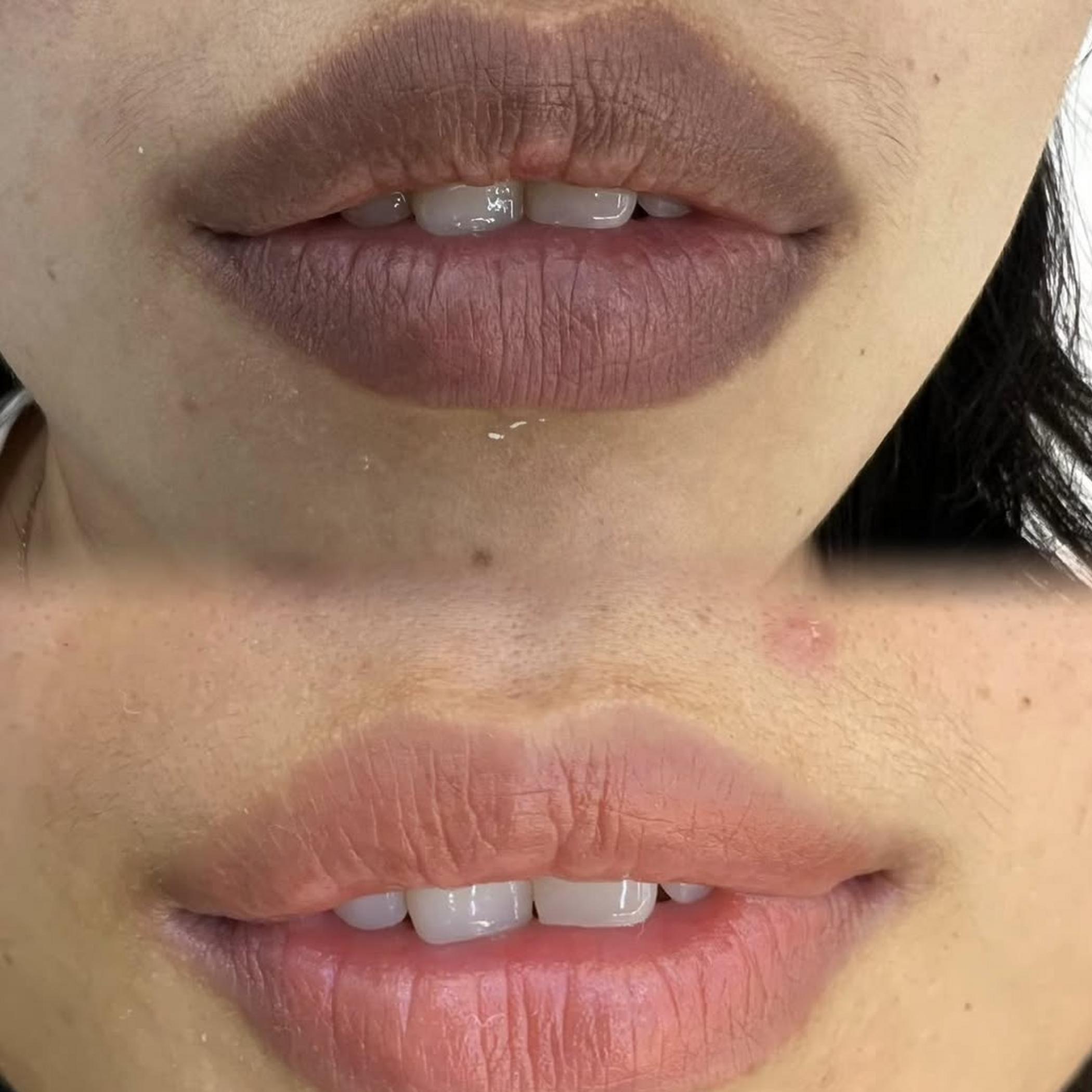 artist working on lip tattoo client