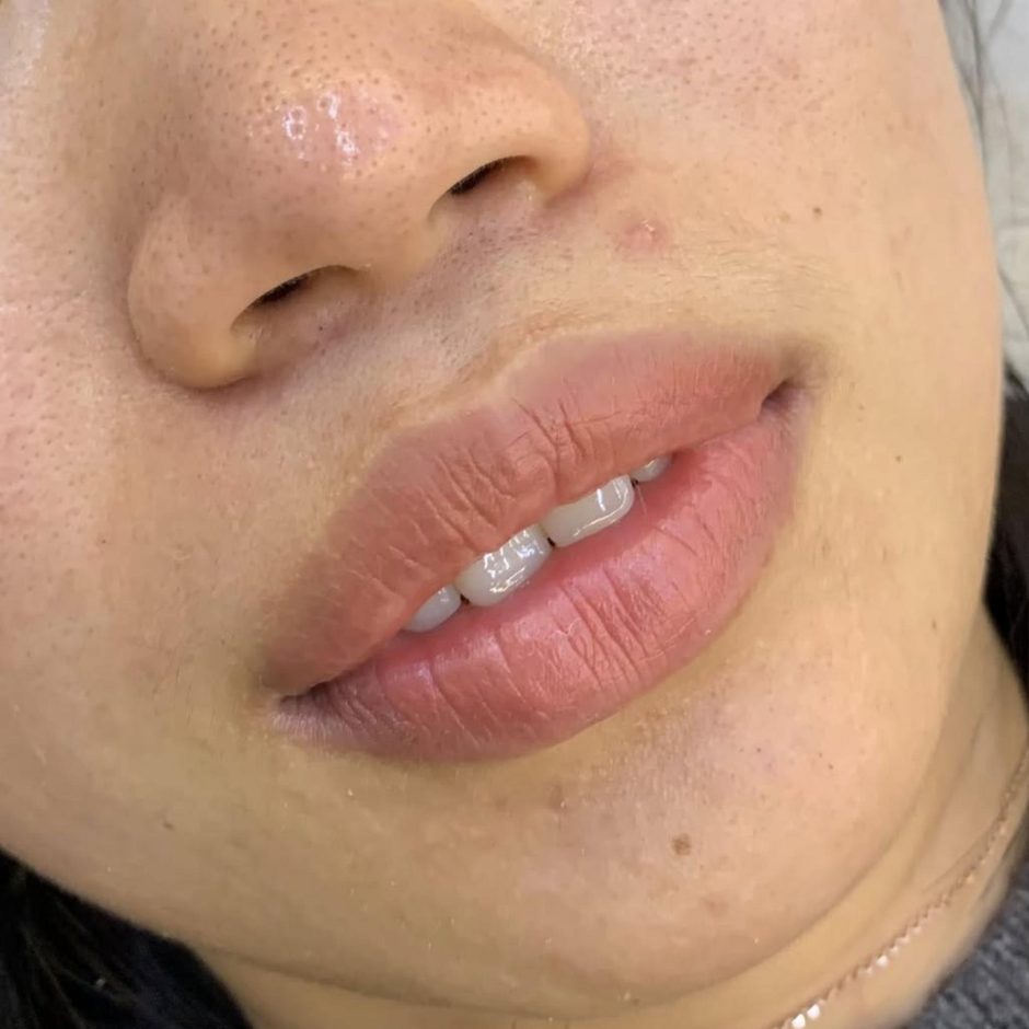 before after lip blush faded borders