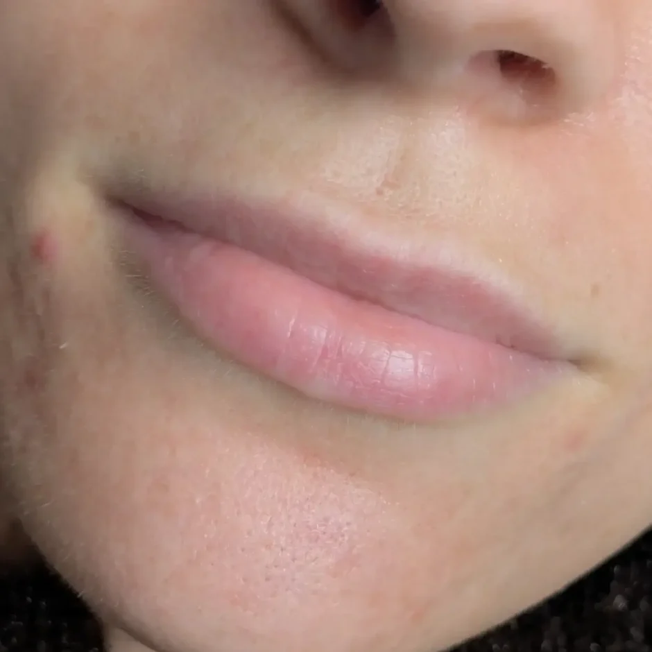 before and after lip tattoo healing