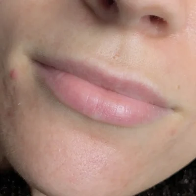 before and after lip tattoo healing
