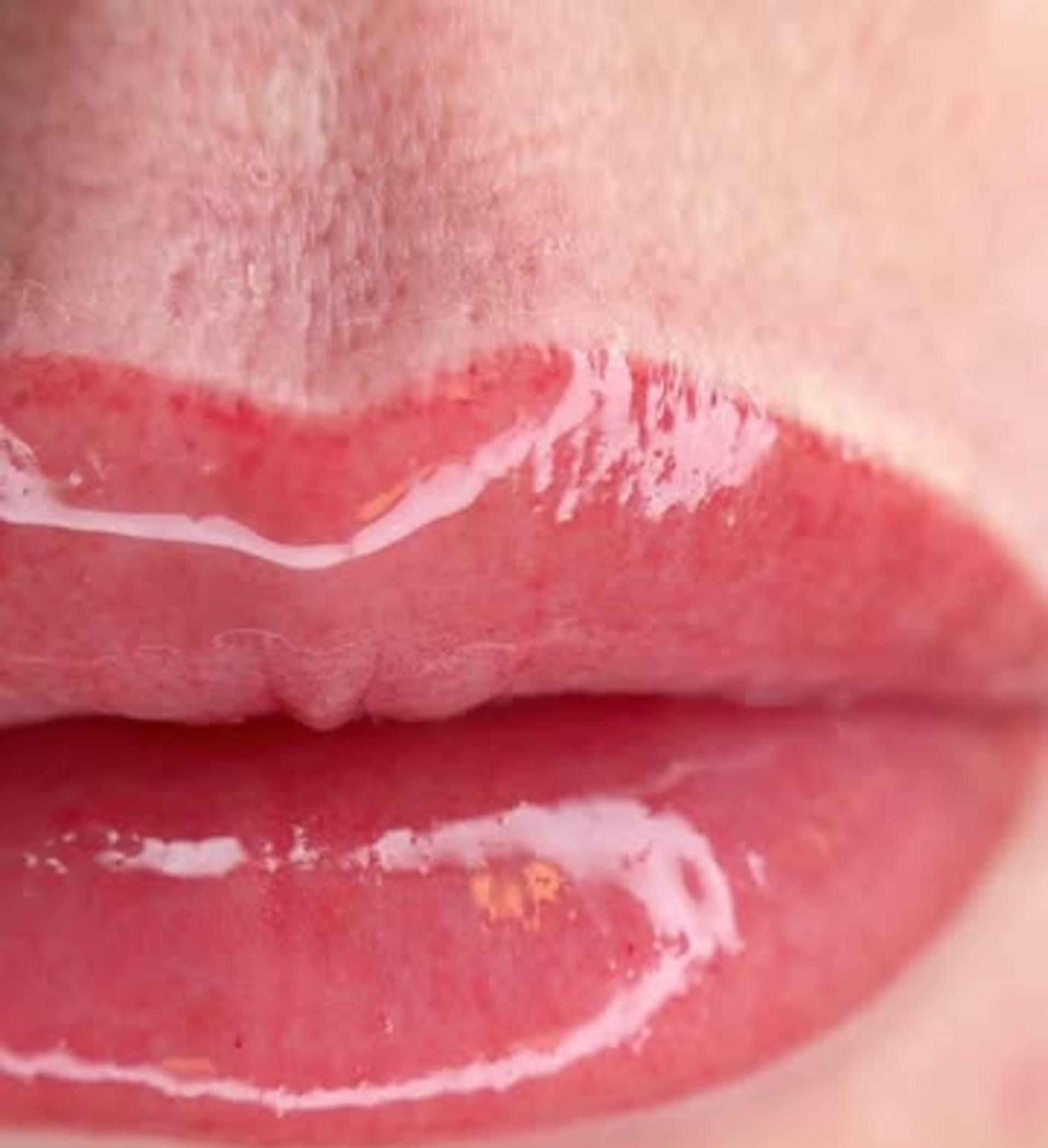 close up fine vertical lip lines