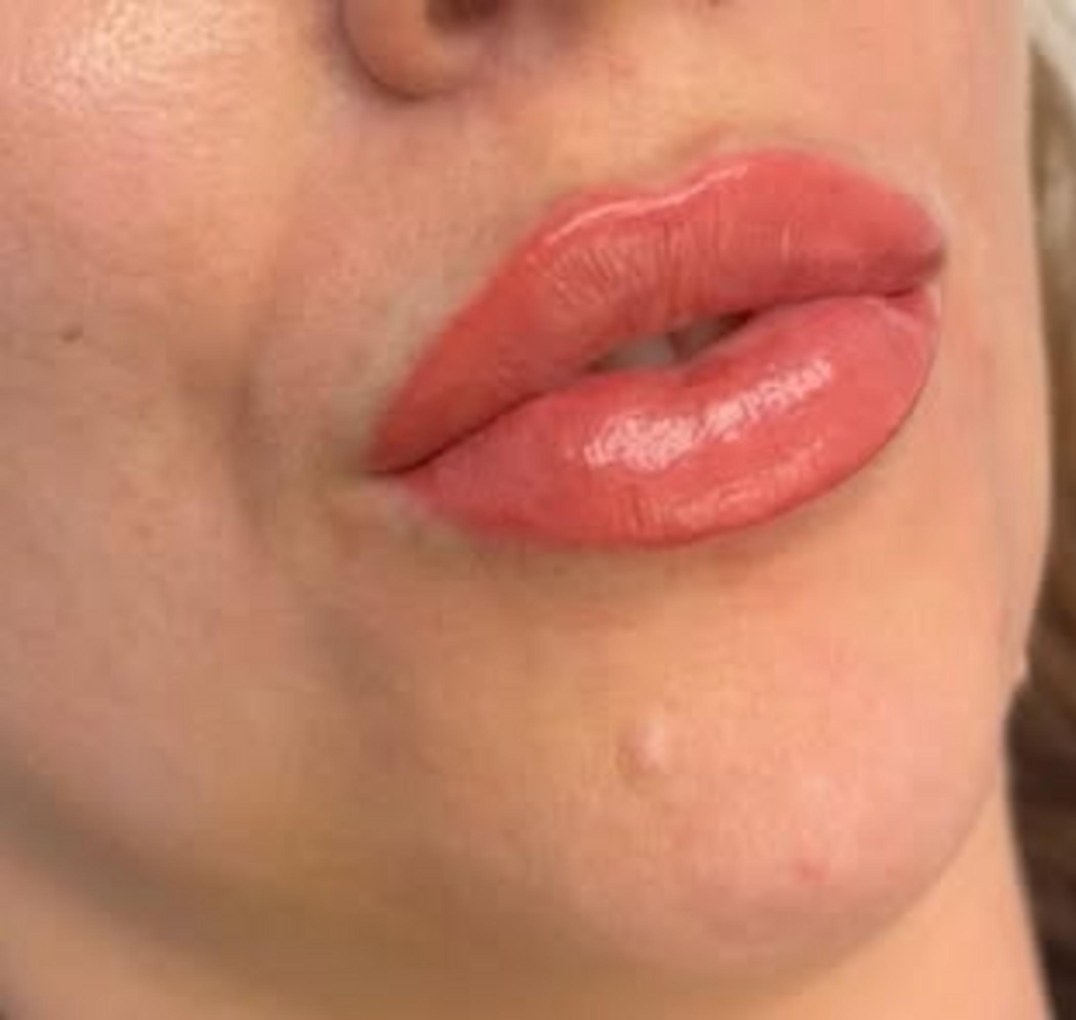 close up peeling lips detail