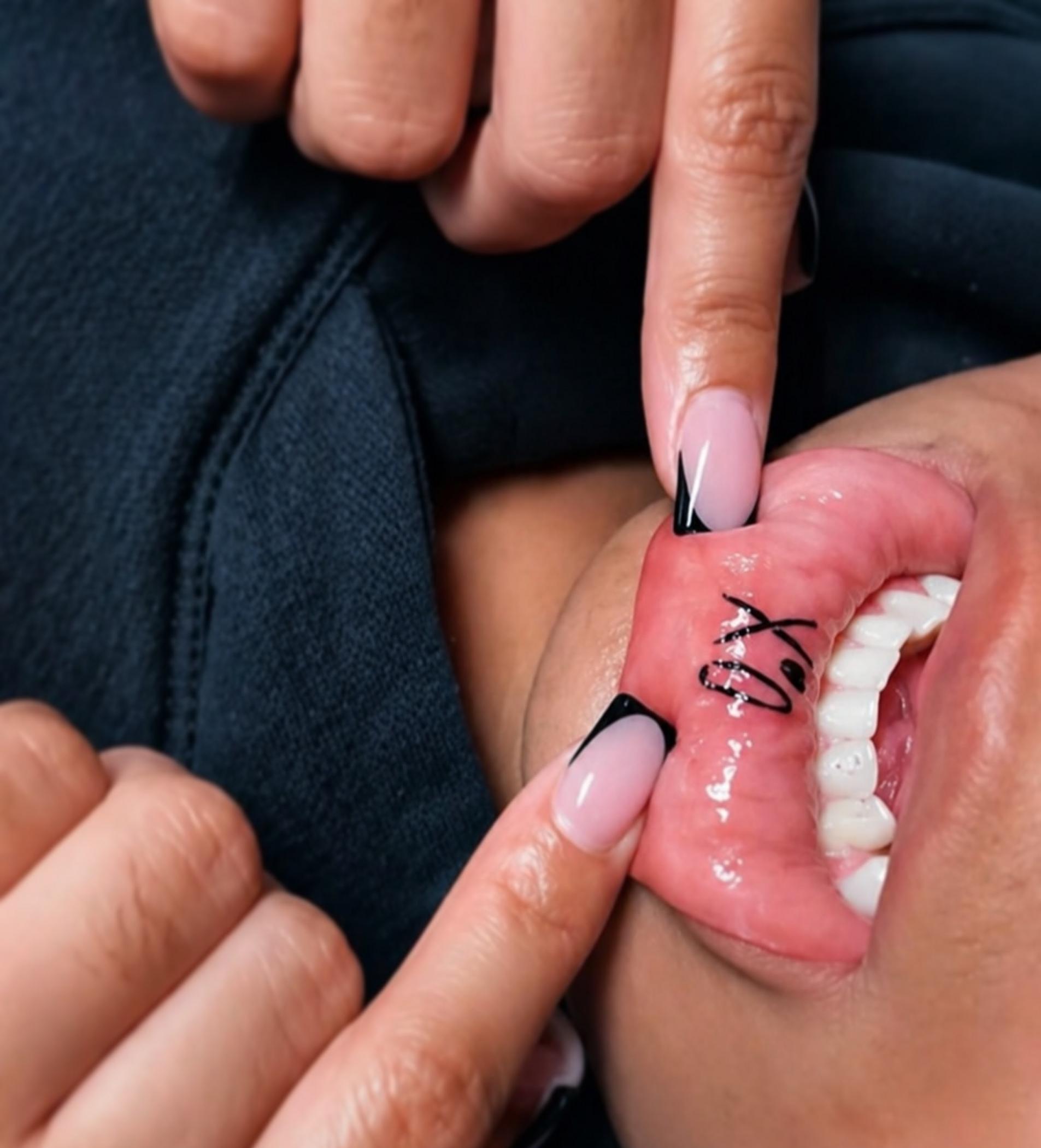 cosmetic tattoo artist performing lip procedure