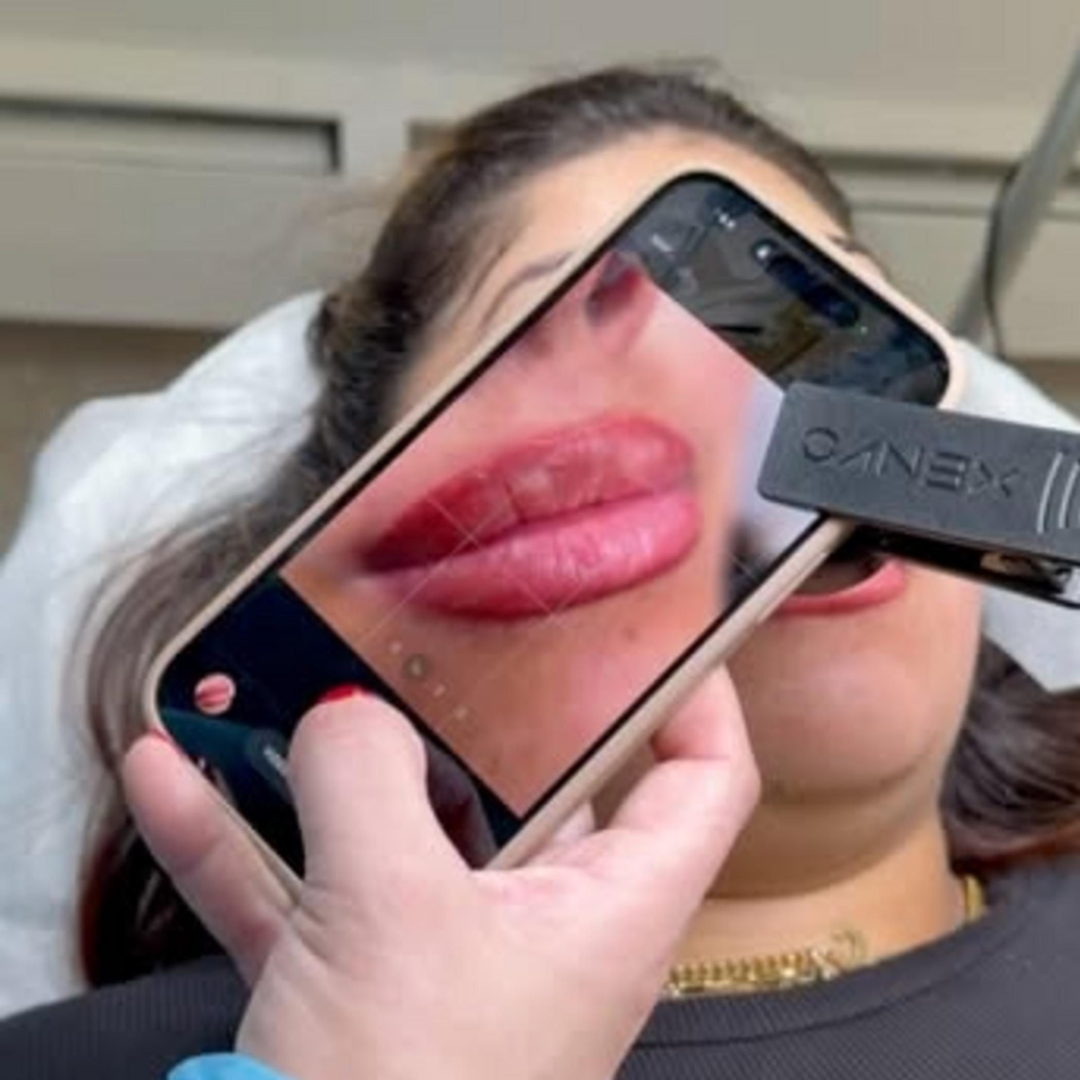 ghosting stage lips healing close view
