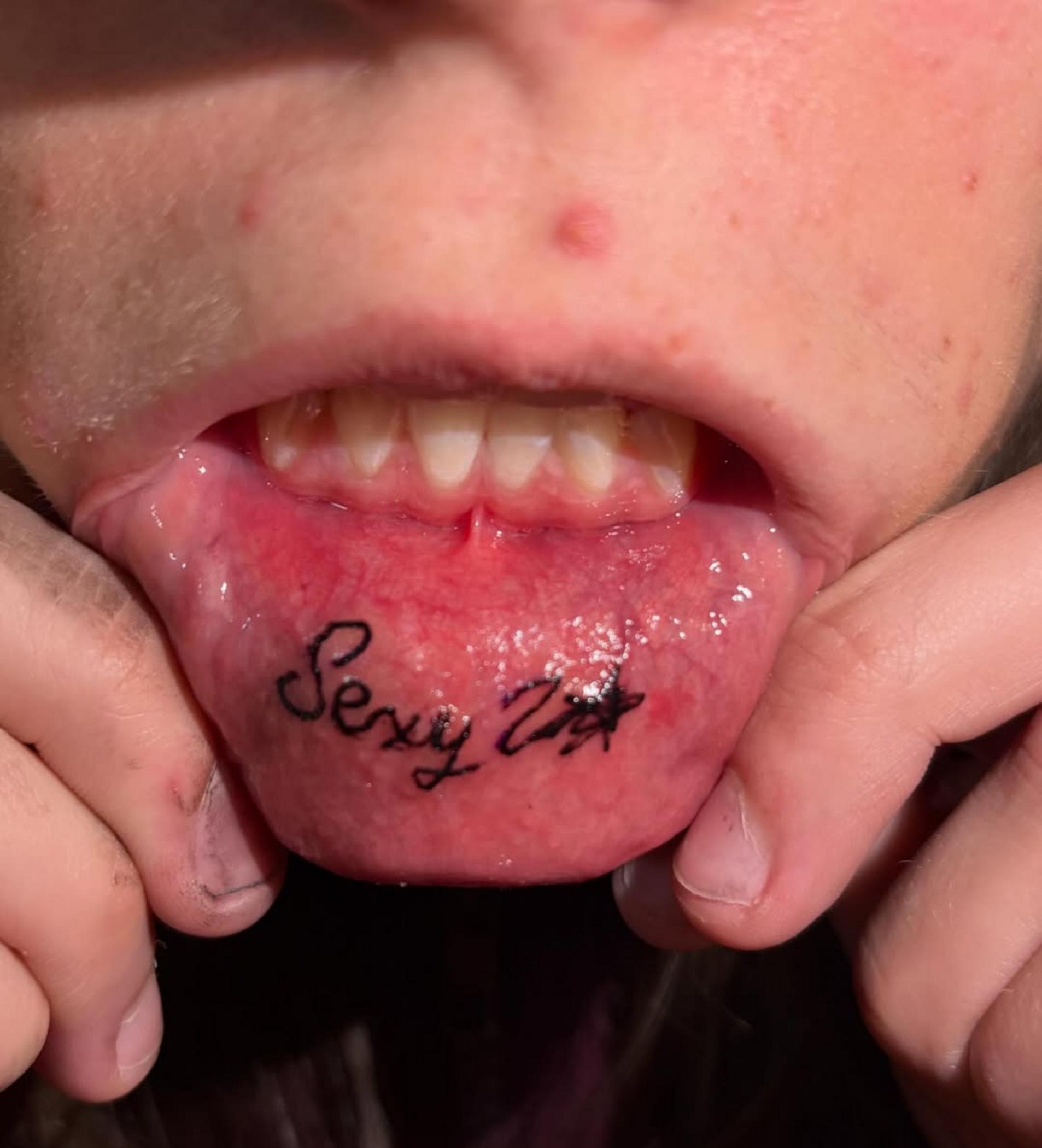 healing stage flaky lips close detail