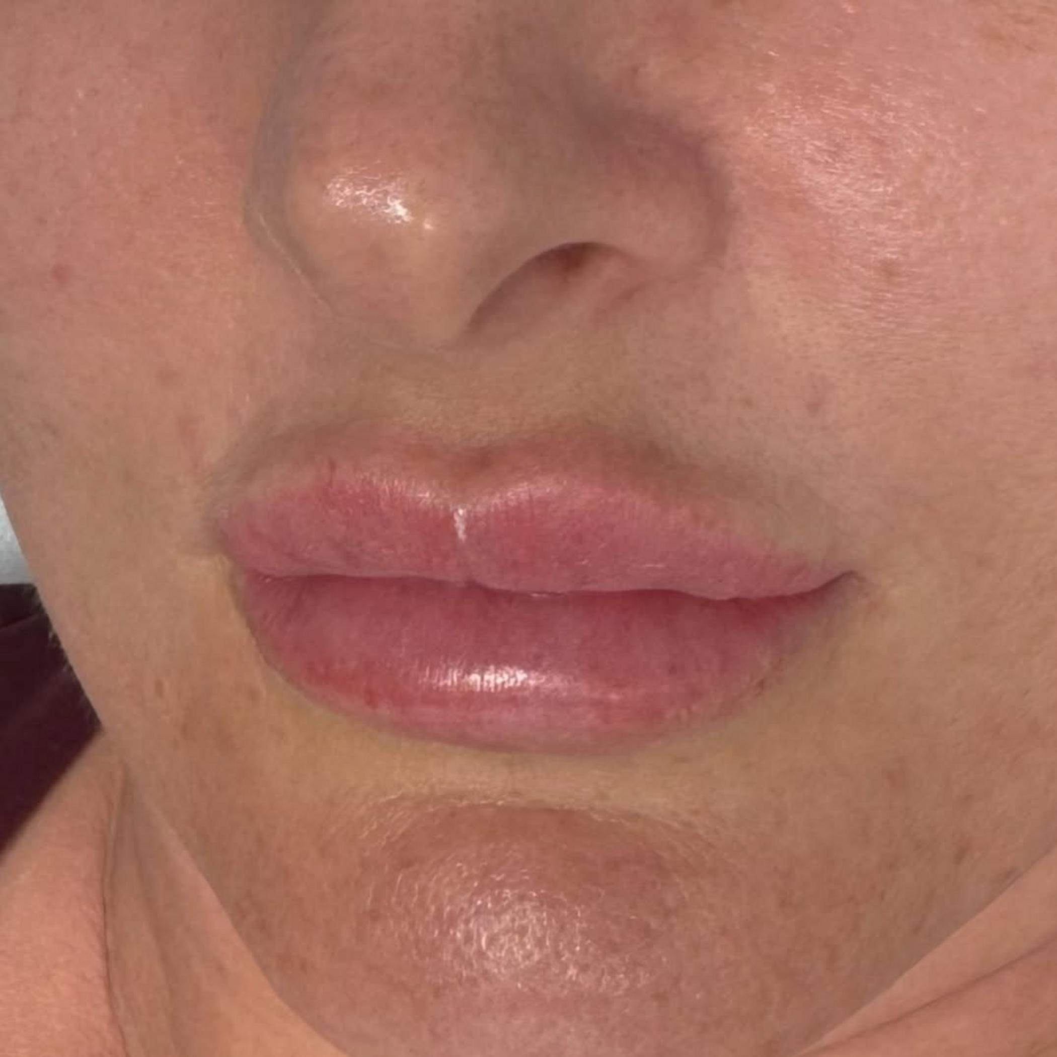 healing stages after lip blush tattoo