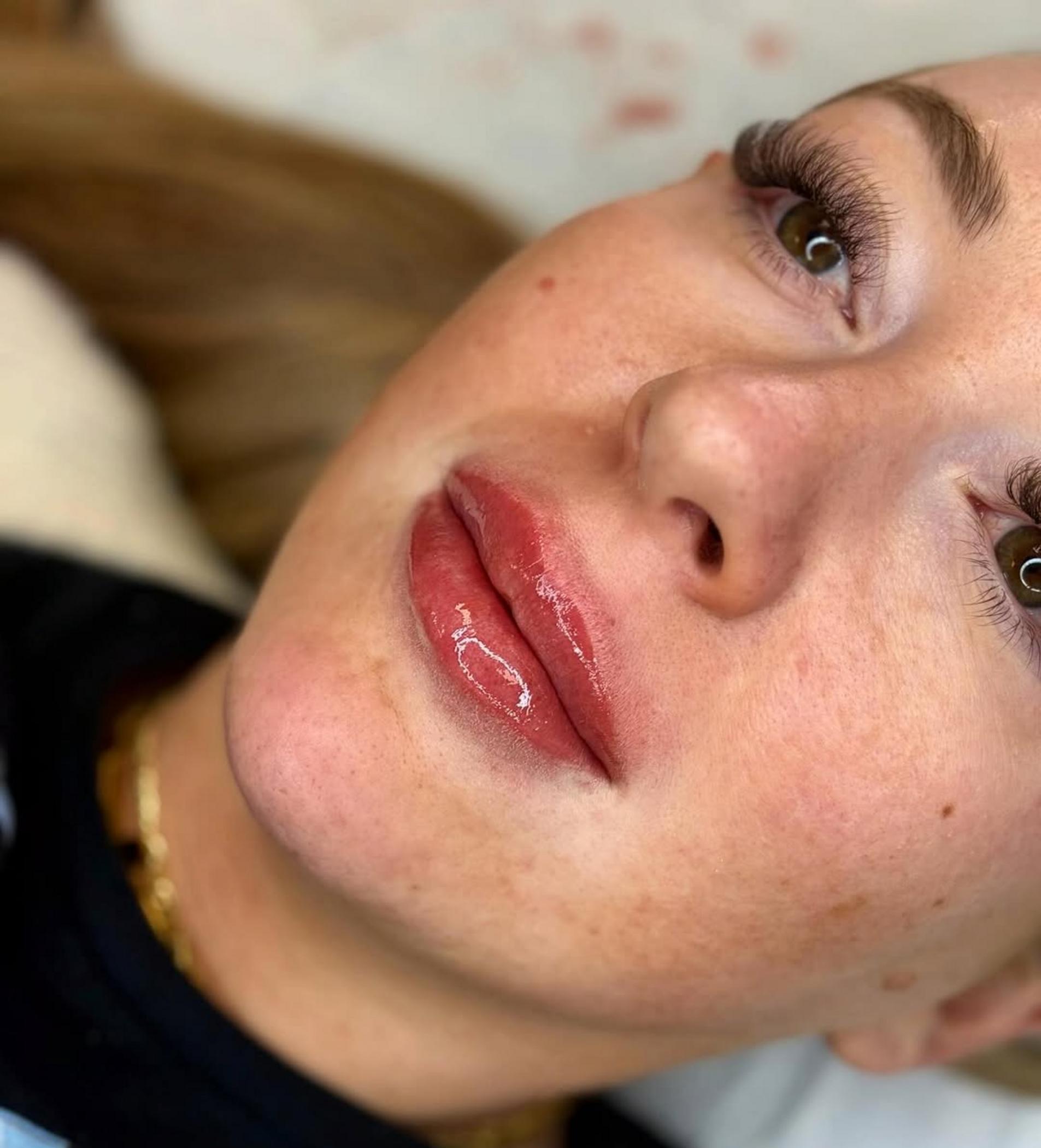 lip tattoo procedure in progress