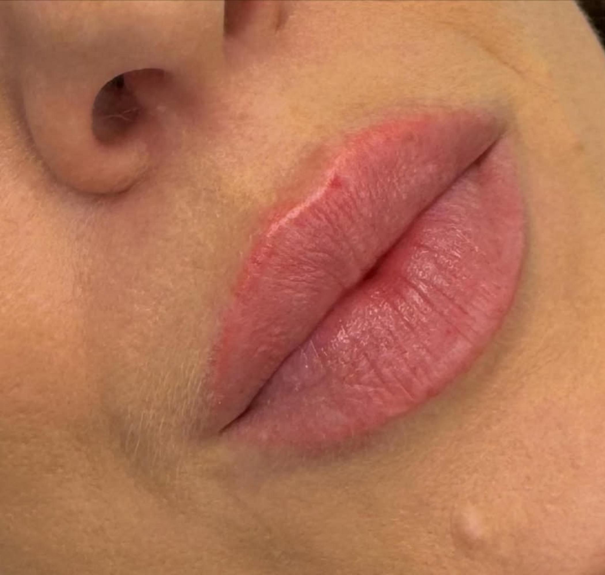 lip tattoo procedure step by step