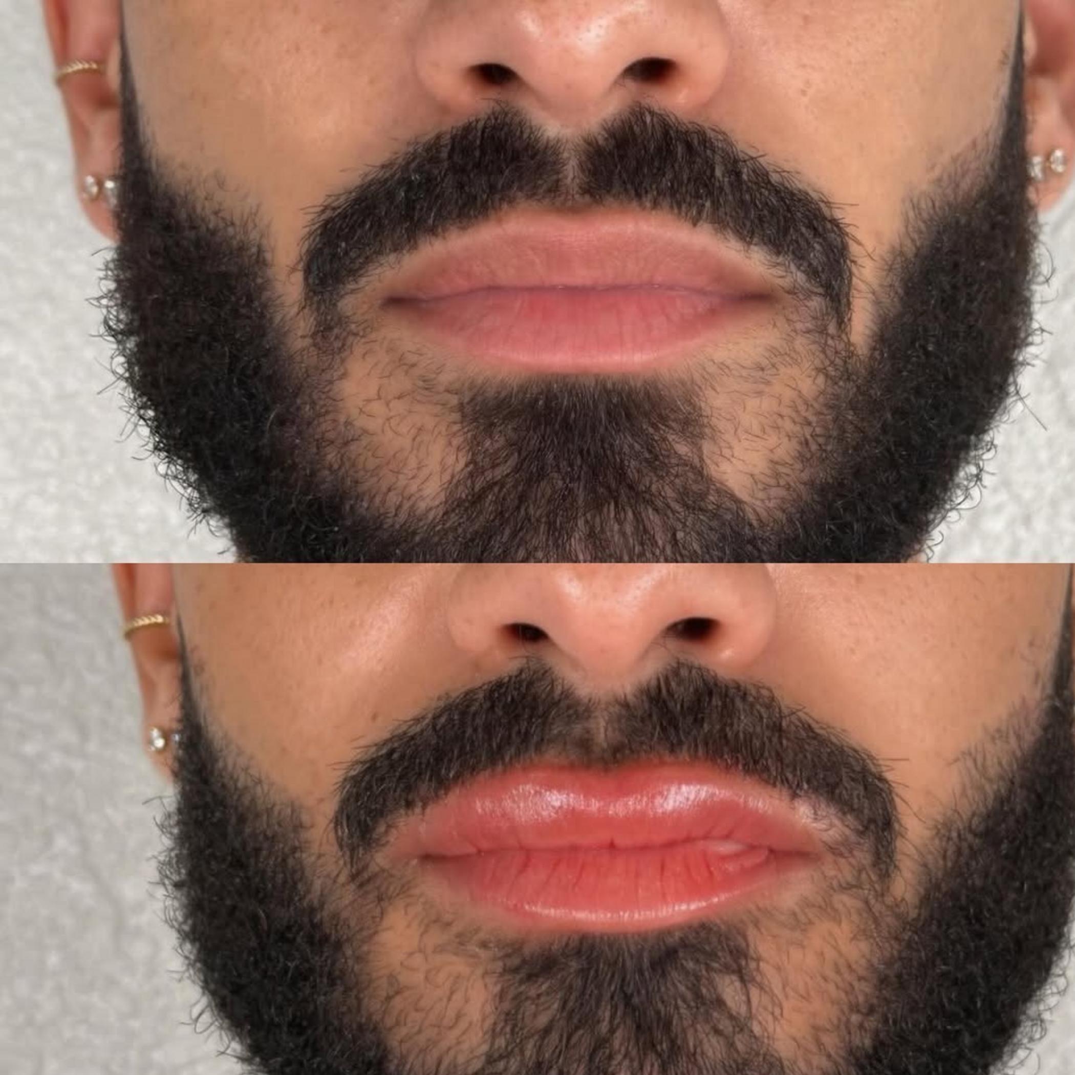 natural subtle lip blush healed results
