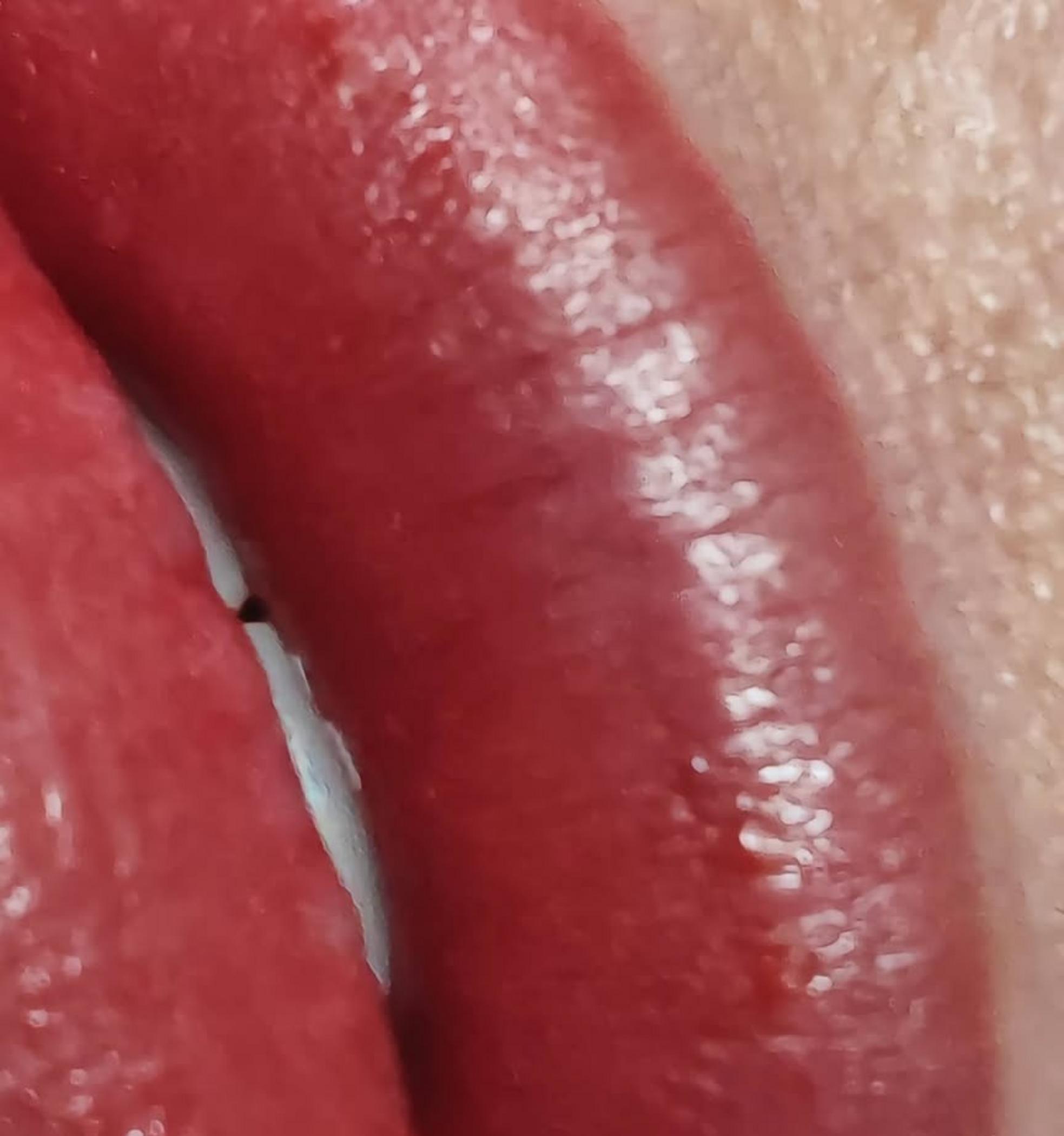 performing aquarelle lip tattoo procedure