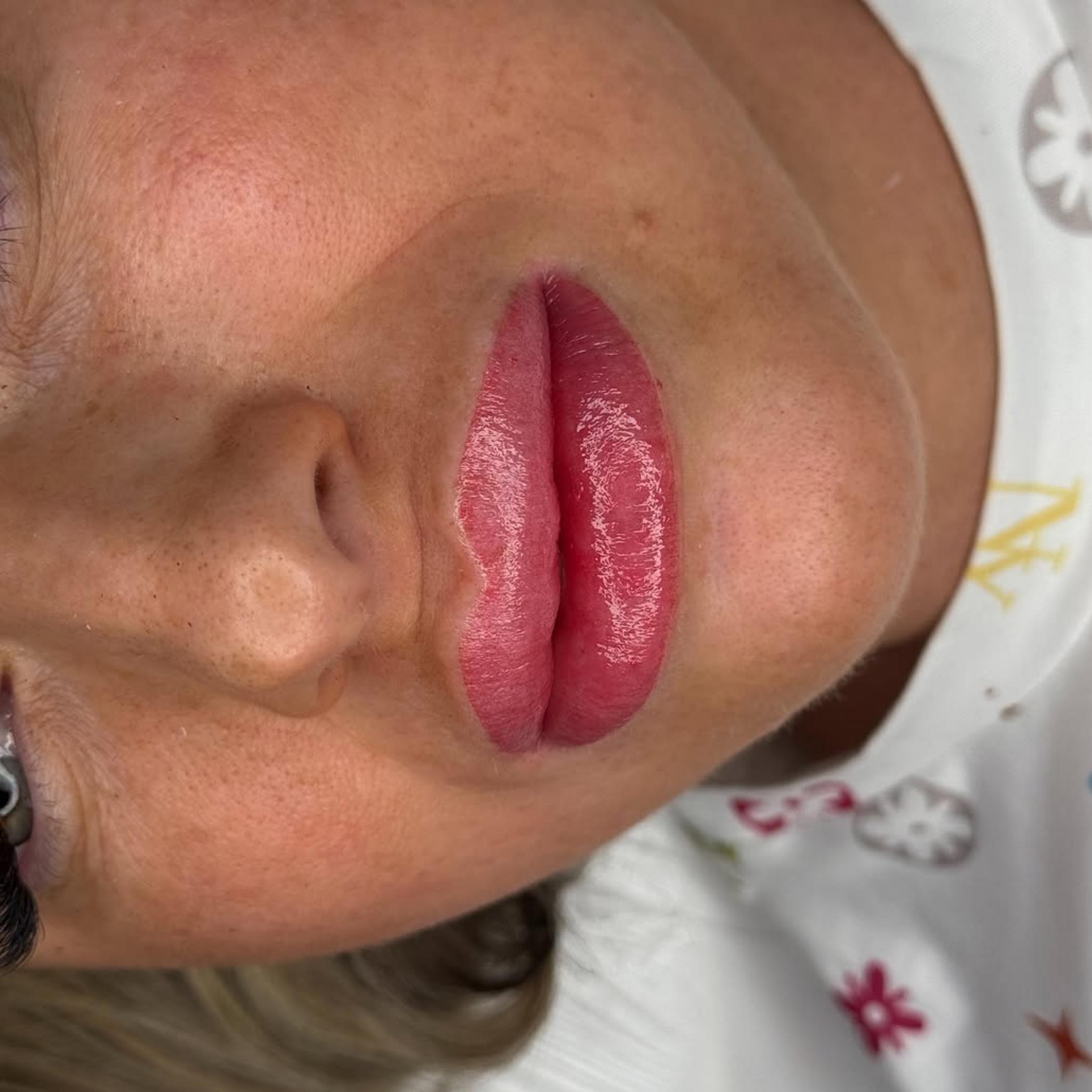 procedure of aquarelle lip tattoo application