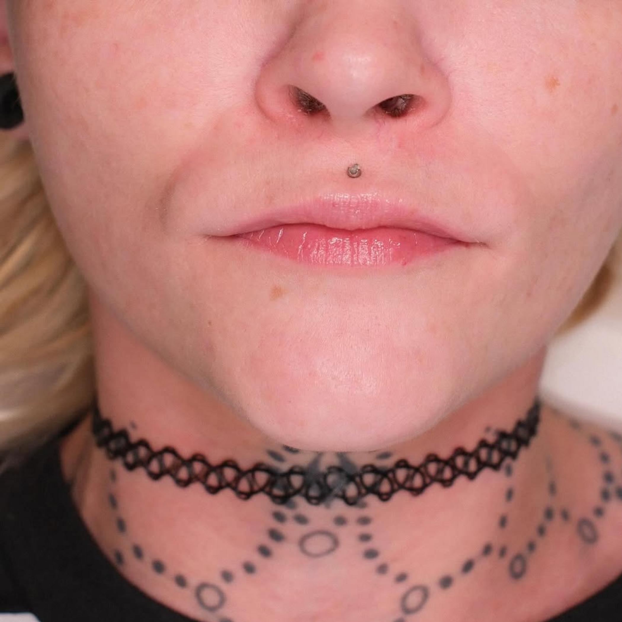 stages of lip blush healing herpes outbreak
